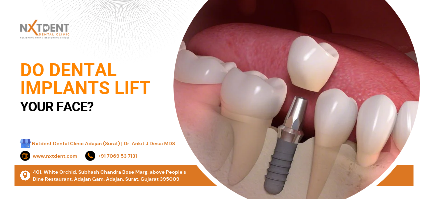 dental implant treatment