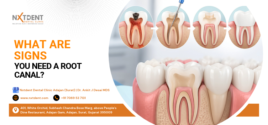 root canal treatment