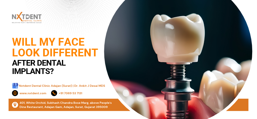 dental implant treatment