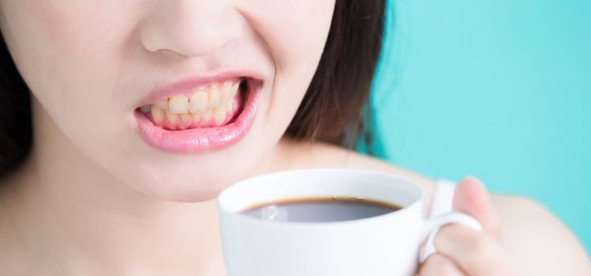 5 Things to Avoid After Whitening Your Teeth