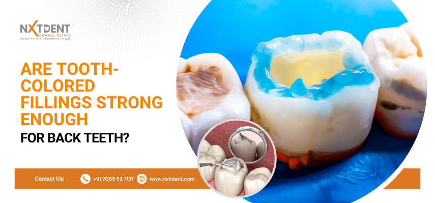 Are Tooth-Colored Fillings Strong Enough for Back Teeth?