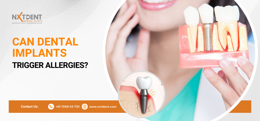 Can dental implants trigger allergies?