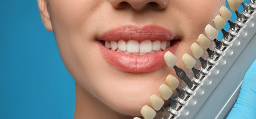 Cosmetic Treatments A Natural Way to Improve Your Oral Health
