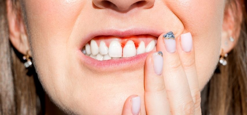 Pyorrhea periodontitis Treatment and prevention measures