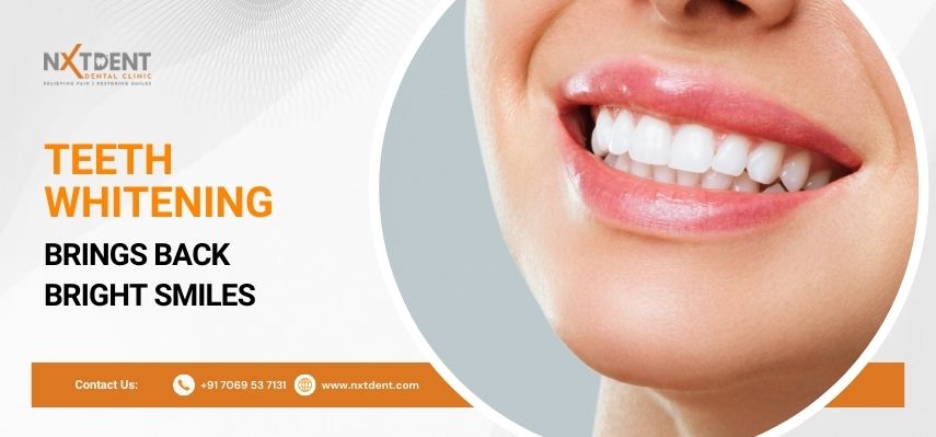 Teeth Whitening Brings Back Bright Smiles