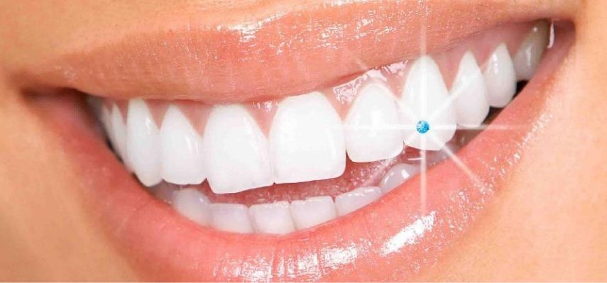 Tooth Jewelry