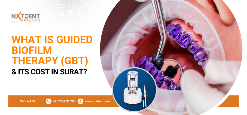 What Is Guided Biofilm Therapy (GBT) & Its Cost in Surat?